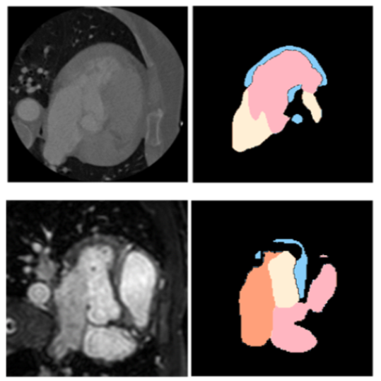 Shape-Consistent GANs teaser